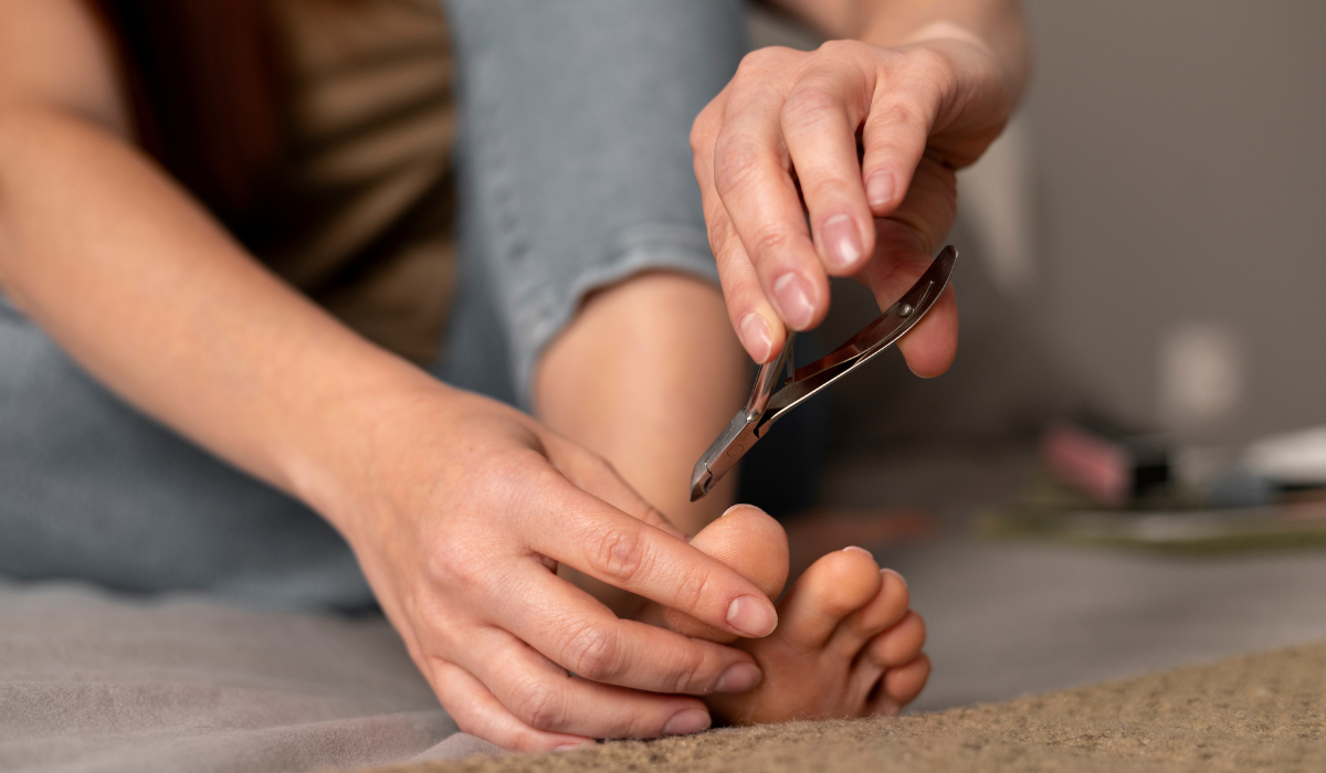 Uña encarnada: causas, tratamiento y prevención